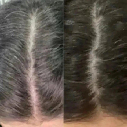 Neofollics anti-grey hair tablets - Hairgivers