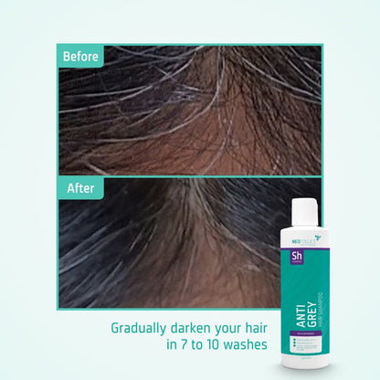 Neofollics anti-grey shampoo