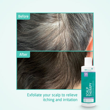 Neofollics exfoliating shampoo
