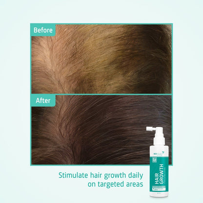 Neofollics hair growth lotion 3-pack (7% Neoxyl)
